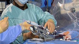 Implant-Files: Herz-OP mit Herzklappenband